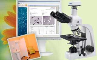 Как выглядит хорошая спермограмма