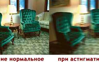 Миопический астигматизм, особенности лечения