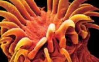 Гомеопатические препараты для лечения паразитов в организме