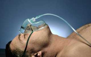 Как помочь человеку при алкогольной коме