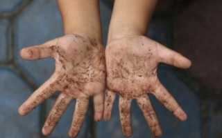 Жиардиазная инфекция