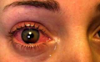 Чем опасно внутриглазное давление? Симптомы патологии