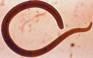 Ancylostoma Duodenale — анкилостома у человека