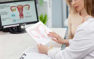 Гинекологическая операция гистероскопия