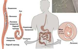 Мнение доктора Комаровского об острицах у детей