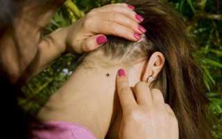 Почему у человека бывает тошнота, головокружение и общая слабость