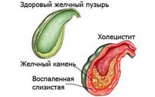 У ребенка сильно болит живот и наблюдается рвота