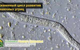 Стронгилоидоз — основные симптомы заболевания и правила лечения