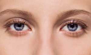 Хронический вид блефарита