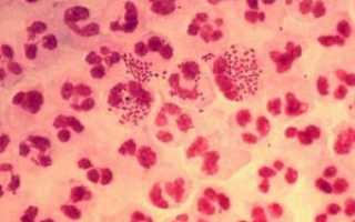 Что такое нейссерия гонорея и какую болезнь вызывает?