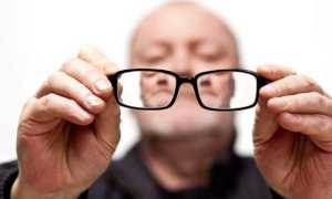 Обратный астигматизм