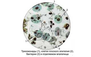 Какие должны быть действия для профилактики трихомониаза?