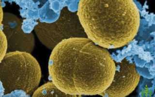 Лечение золотистого стафилококка народными средствами