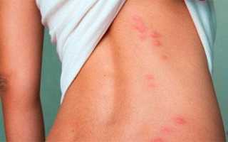 Как провести чистку желудка и кишечника в домашних условиях