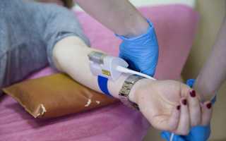 Очищение крови лазером: суть и преимущества процедуры