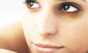 Эффективные способы от избавления синяков под глазами