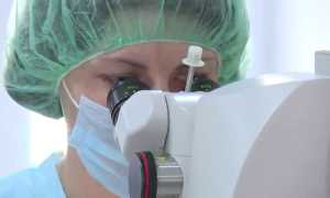 Причина косоглазия: диагностика и профилактика патологии