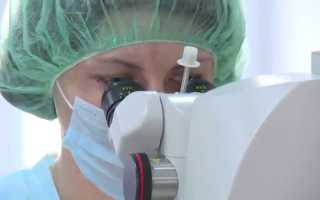 Причина косоглазия: диагностика и профилактика патологии