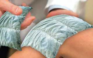 Симптомы и лечение отравления димексидом