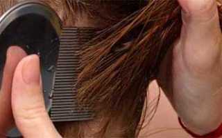 Способы передачи паразитов: прыгают ли вши?