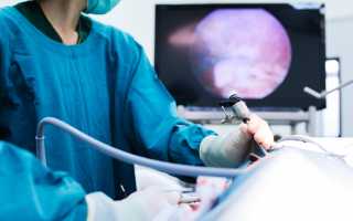 Можно ли делать лапароскопию