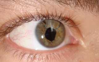 Регматогенная отслойка сетчатки