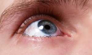 Отслоение сетчатки, что это за болезнь?