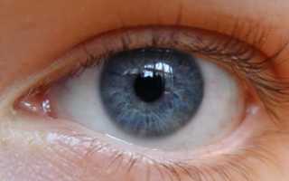 Симптомы наличия астигматизма