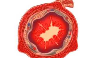 У ребенка появился понос белого цвета: когда следует бить тревогу