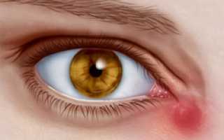 Слезоточивость глаз у детей и взрослых, лечение патологии