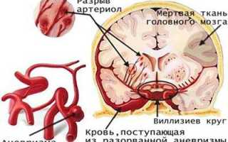 Головной мозг и алкоголь – причины и последствия отравления