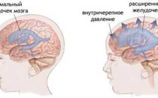 Диетическое питание при гастроэнтерите