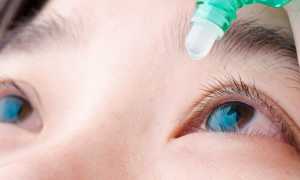 Симптомы, диагностика и лечение конъюнктивита у взрослых