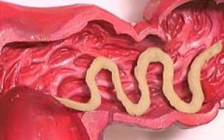 Самые опасные паразиты в организме человека