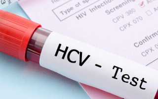 Ложноположительный анализ на гепатит с причины
