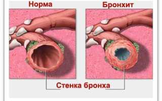 Симптомы и помощь при передозировке мукалтина