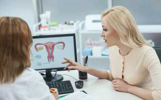 Профилактика и лечение гинекологических заболеваний