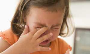 Почему появляется конъюнктивит у детей? Профилактика недуга