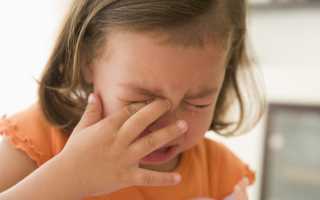 Почему появляется конъюнктивит у детей? Профилактика недуга