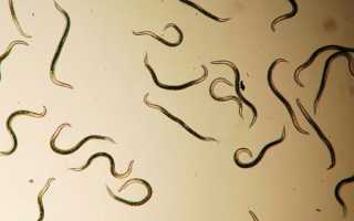 Что делать, если в кале обнаружены маленькие белые глисты?