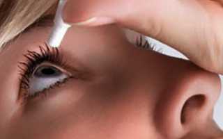 Снятие воспаления глаз с помощью примочек