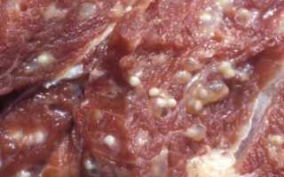 Жизненный цикл трихинеллы: признаки паразита в организме человека и лечение заболевания