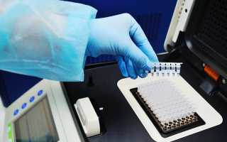 Псевдомицелий в мазке: что это значит