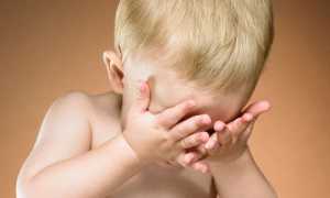 Виды лечений конъюнктивита у новорожденных