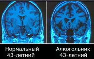 Если стало плохо после алкоголя, что делать