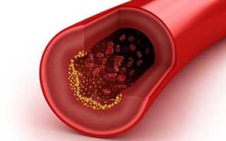 Полезные свойства и правила приема свекольного сока