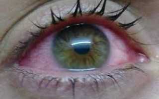 Самые часто встречающиеся глазные заболевания