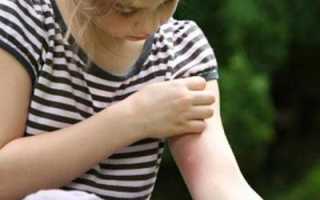 Что такое экзогенная интоксикация