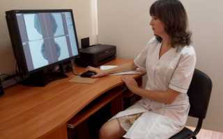 Дисгормональные молочные железы