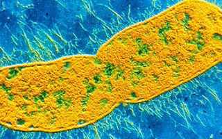 Клебсиелла у грудничка в кале: причины и лечение